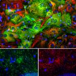 ALDH1L1 Antibody in Immunocytochemistry (ICC/IF)