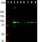 ALDH1L1 Antibody in Western Blot (WB)