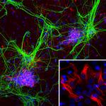 Nestin Antibody in Immunocytochemistry (ICC/IF)