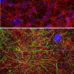 GAP43 Antibody in Immunocytochemistry (ICC/IF)