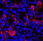 SARS-CoV-2 Spike Protein RBD Antibody in Immunocytochemistry (ICC/IF)