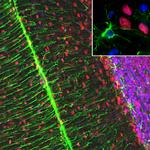 MECP2 Antibody in Immunohistochemistry (PFA fixed) (IHC (PFA))