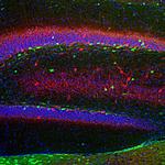 Calretinin Antibody in Immunohistochemistry (PFA fixed) (IHC (PFA))