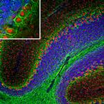 NEFL Antibody in Immunohistochemistry (PFA fixed) (IHC (PFA))