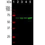 NEFL Antibody in Western Blot (WB)