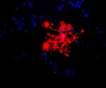 MBP Antibody in Immunocytochemistry (ICC/IF)