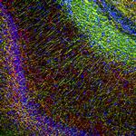 MBP Antibody in Immunohistochemistry (IHC)