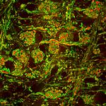 MBP Antibody in Immunohistochemistry (IHC)