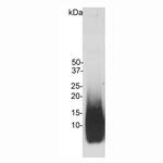 beta Amyloid Antibody in Western Blot (WB)