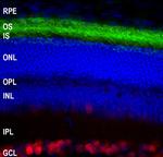 Rhodopsin Antibody in Immunohistochemistry (IHC)