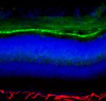 S-arrestin Antibody in Immunohistochemistry (IHC)