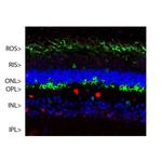 S-arrestin Antibody in Immunohistochemistry (IHC)