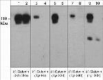 Phospho-delta Catenin (Tyr228) Antibody in Western Blot (WB)