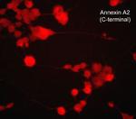 Annexin A2 Antibody in Immunocytochemistry (ICC/IF)