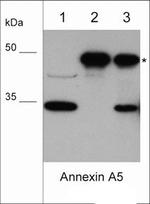 Annexin V Antibody in Western Blot (WB)