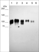 B7-H3 (CD276) Antibody in Western Blot (WB)