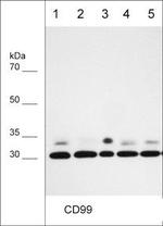 CD99 Antibody in Western Blot (WB)