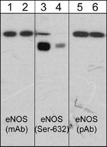 eNOS Antibody in Western Blot (WB)