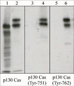 p130Cas Antibody in Western Blot (WB)