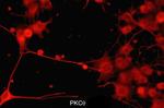 PKC theta Antibody in Immunocytochemistry (ICC/IF)