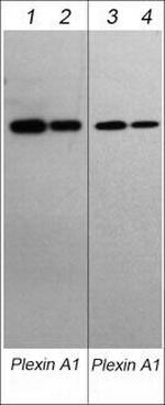 Plexin-A1 Antibody in Western Blot (WB)