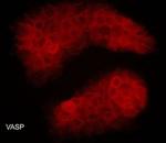 VASP Antibody in Immunocytochemistry (ICC/IF)