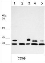 CD99 Antibody in Western Blot (WB)