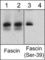 Fascin Antibody in Western Blot (WB)