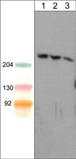 SHANK1 Antibody in Western Blot (WB)