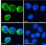 CD2 Chimeric Antibody in Immunocytochemistry (ICC/IF)