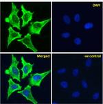 AOC3 Chimeric Antibody in Immunocytochemistry (ICC/IF)