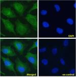 NOTCH2 Chimeric Antibody in Immunocytochemistry (ICC/IF)