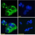 AFP Chimeric Antibody in Immunocytochemistry (ICC/IF)