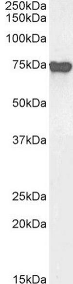 AFP Chimeric Antibody in Western Blot (WB)