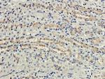 CD35 Chimeric Antibody in Immunohistochemistry (PFA fixed) (IHC (PFA))