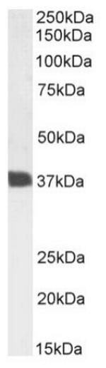 CD7 Chimeric Antibody in Western Blot (WB)