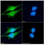 HSP27 Antibody in Immunocytochemistry (ICC/IF)