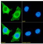 HSP27 Antibody in Immunocytochemistry (ICC/IF)