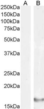 IL-18 Antibody in Western Blot (WB)