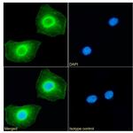 RRM2 Antibody in Immunocytochemistry (ICC/IF)