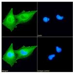 gamma Synuclein Antibody in Immunocytochemistry (ICC/IF)