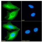 Fascin Antibody in Immunocytochemistry (ICC/IF)