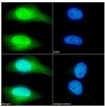 TAGLN Antibody in Immunocytochemistry (ICC/IF)