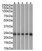 TAGLN Antibody in Western Blot (WB)