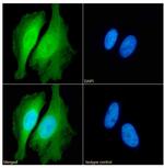 PRDX2 Antibody in Immunocytochemistry (ICC/IF)