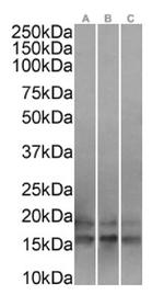 UBE2C Antibody in Western Blot (WB)