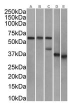 Apolipoprotein J Antibody in Western Blot (WB)