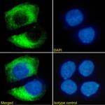 ErbB2 (HER-2) Antibody in Immunocytochemistry (ICC/IF)