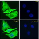 beta Tubulin Chimeric Antibody in Immunocytochemistry (ICC/IF)