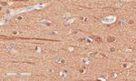 beta Tubulin Chimeric Antibody in Immunohistochemistry (Paraffin) (IHC (P))